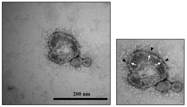 두피유래 유산균 엑소좀 이미지 - 전자 현미경 사진. 사진=지에프씨생명과학.
